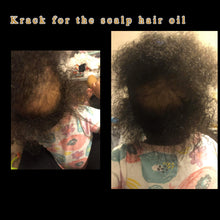 Load image into Gallery viewer, &quot;Krack For the Scalp&quot; Hair Oil
